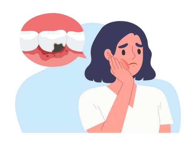 Obat Alami Untuk Sakit Gigi: Meredakan Nyeri dengan Bahan dari Dapur