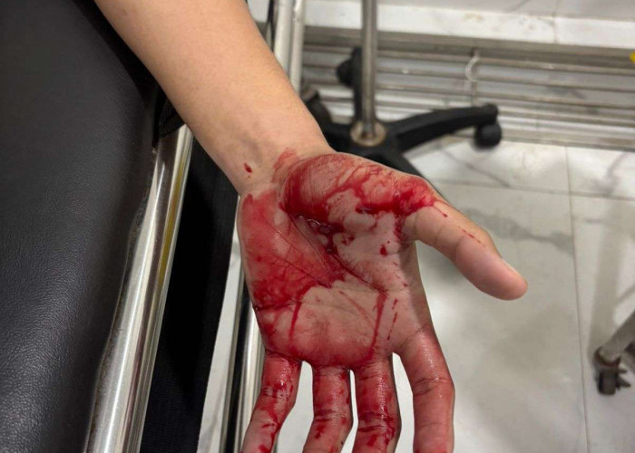 Diduga Dianiaya di Kosan Rajabasa, Korban Lapor Polisi, Peran Ayah Terlapor Pensiunan Polisi Diminta Diusut