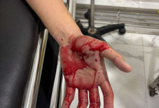 Diduga Dianiaya di Kosan Rajabasa, Korban Lapor Polisi, Peran Ayah Terlapor Pensiunan Polisi Diminta Diusut