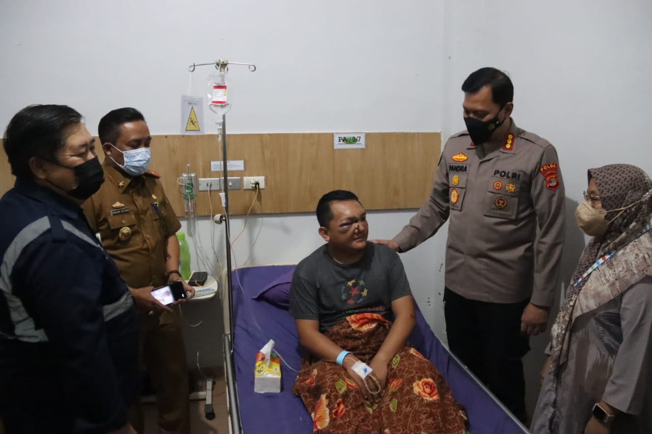Kadis Kominfotik Provinsi Lampung dan Kabid Humas Polda Lampung Kunjungi Korban Kecelakaan Kereta Api